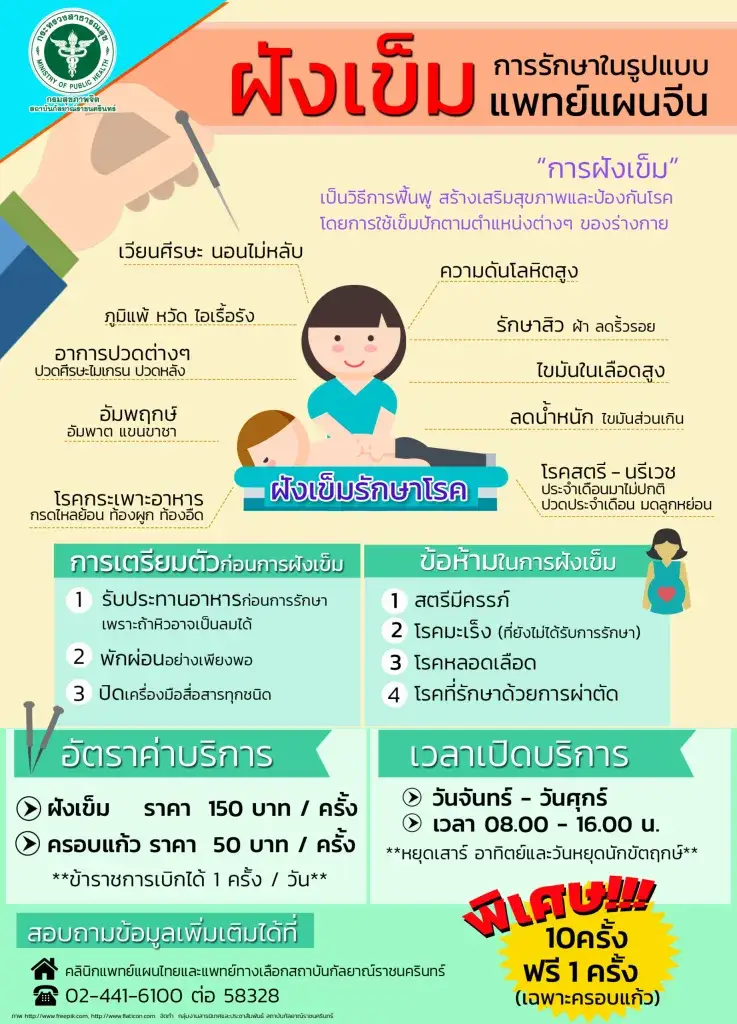 การฝังเข็ม การรักษาในรูปแบบแพทย์แผนจีน